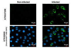 Anti-Zika virus Envelope protein antibody [HL1699] used in Immunocytochemistry/ Immunofluorescence (ICC/IF). GTX637298